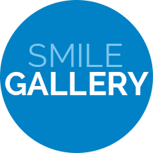 smile gallery